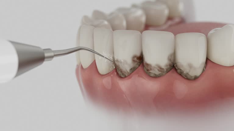 Reliable Dental contractor in Perry, KS by Smile Center Dentistry